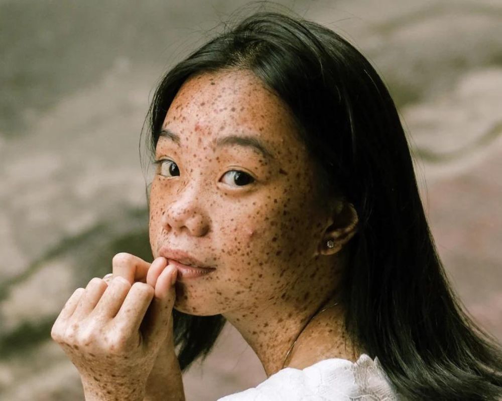 Five Natural Ingredient For Oily Skin